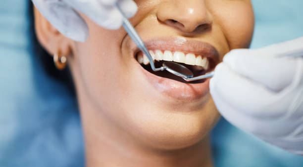 Best Emergency Tooth Extraction in Apache, OK