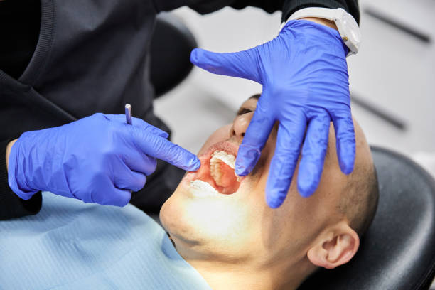 Best Emergency Denture Repair in Apache, OK
